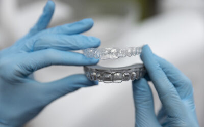 What Are Clear Aligners? A Cost-Effective Alternative for Smile Correction