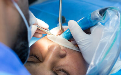 Understanding Maxillofacial Surgery: A Beginner’s Guide