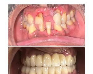 Dental Treatment Trivandrum