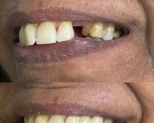 best dental clinic trivandrum
