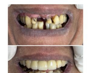 best dental clinic trivandrum