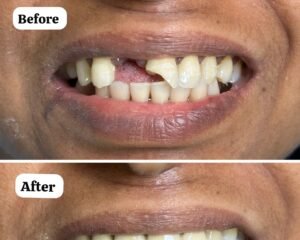 dental clinic trivandrum