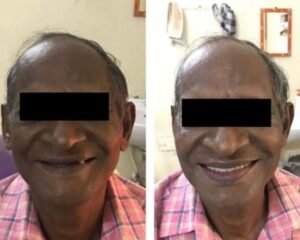 dental clinic trivandrum
