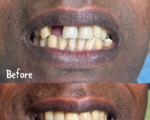 Smile Treatment trivandrum