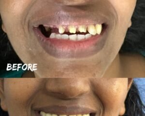 Smile Treatment trivandrum