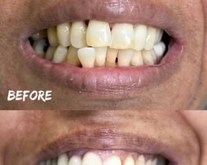 dental clinic trivandrum