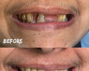 best maxillofacial surgeon in trivandrum