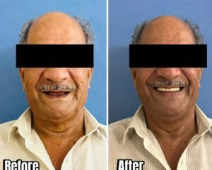 dental clinic trivandrum