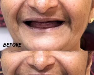 best clinic for dental implants