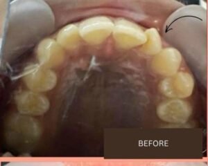 best clinic for dental implants