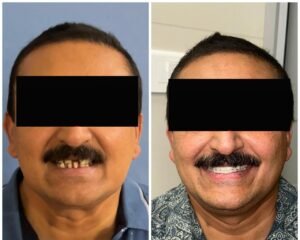 Smile Treatment Trivandrum