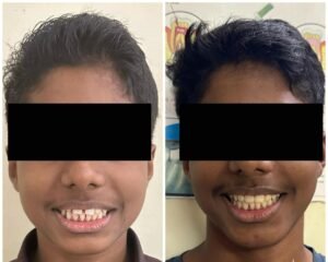 dental care trivandrum