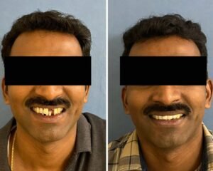 best dental clinic trivandrum