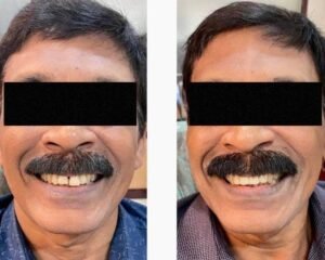 best dental clinic trivandrum