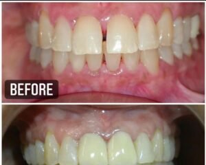 best dental clinic trivandrum