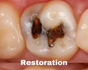 best dental clinic trivandrum