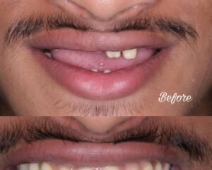 best dental clinic trivandrum