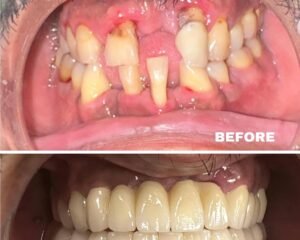 best dental clinic trivandrum
