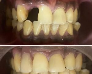 best dental clinic trivandrum