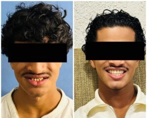 best dental clinic trivandrum