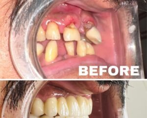 best dental clinic trivandrum