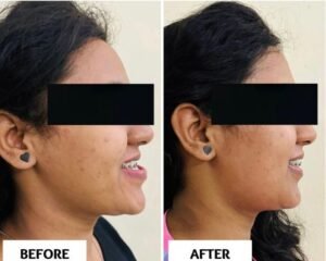 best dental clinic trivandrum