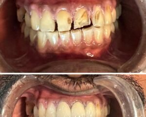 best dental clinic trivandrum