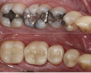 best dental clinic trivandrum