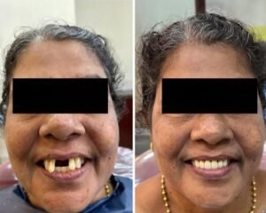best dental clinic trivandrum