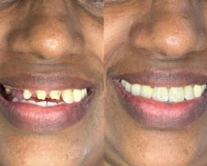 best dental clinic trivandrum