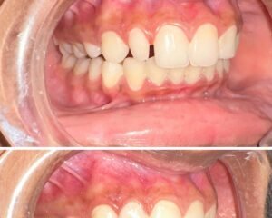 best dental clinic trivandrum
