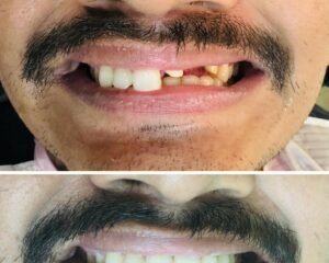 best dental clinic trivandrum