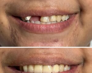 best dental clinic trivandrum