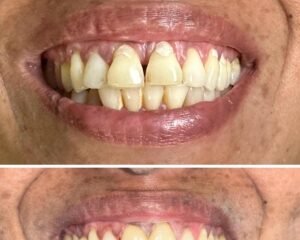 best dental clinic trivandrum