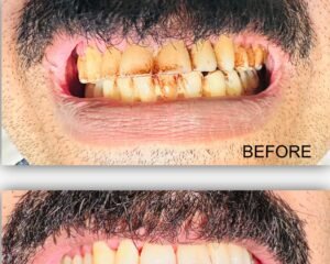 best dental clinic trivandrum