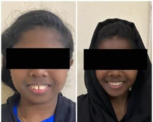 dental care trivandrum