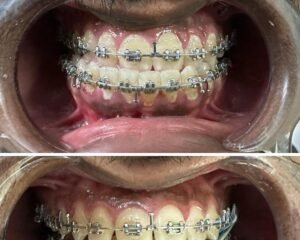 best dental clinic trivandrum