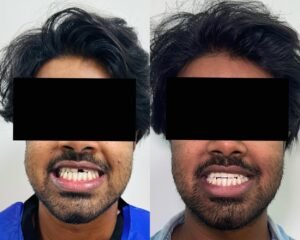 best dental clinic trivandrum