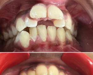 best dental clinic trivandrum
