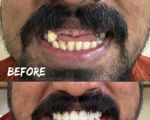 best dental clinic trivandrum