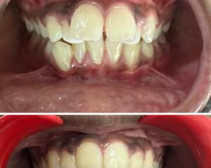 best dental clinic trivandrum