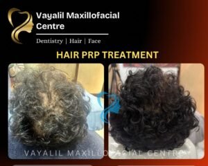 best hair fall treatment trivandrum